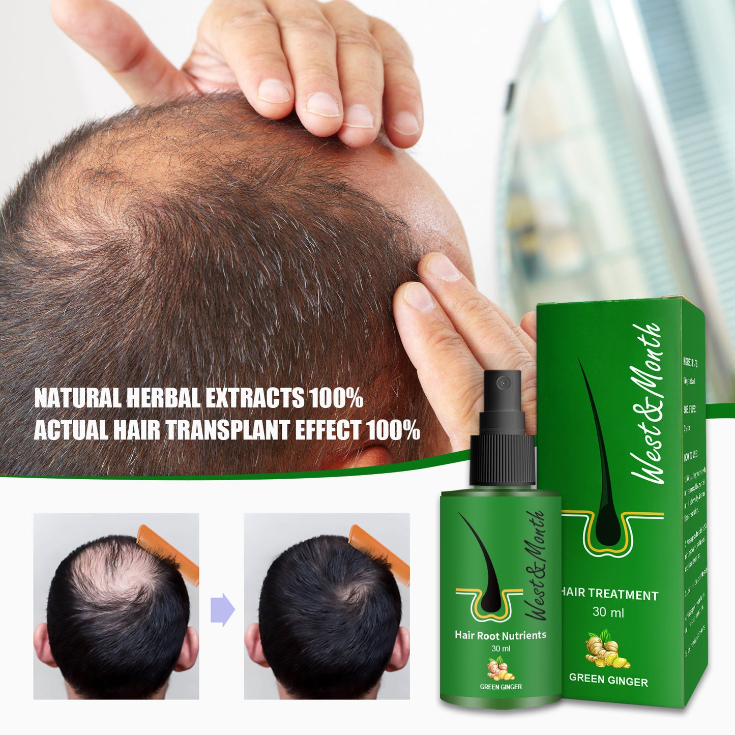 Sparkery West and Month Hair Booster