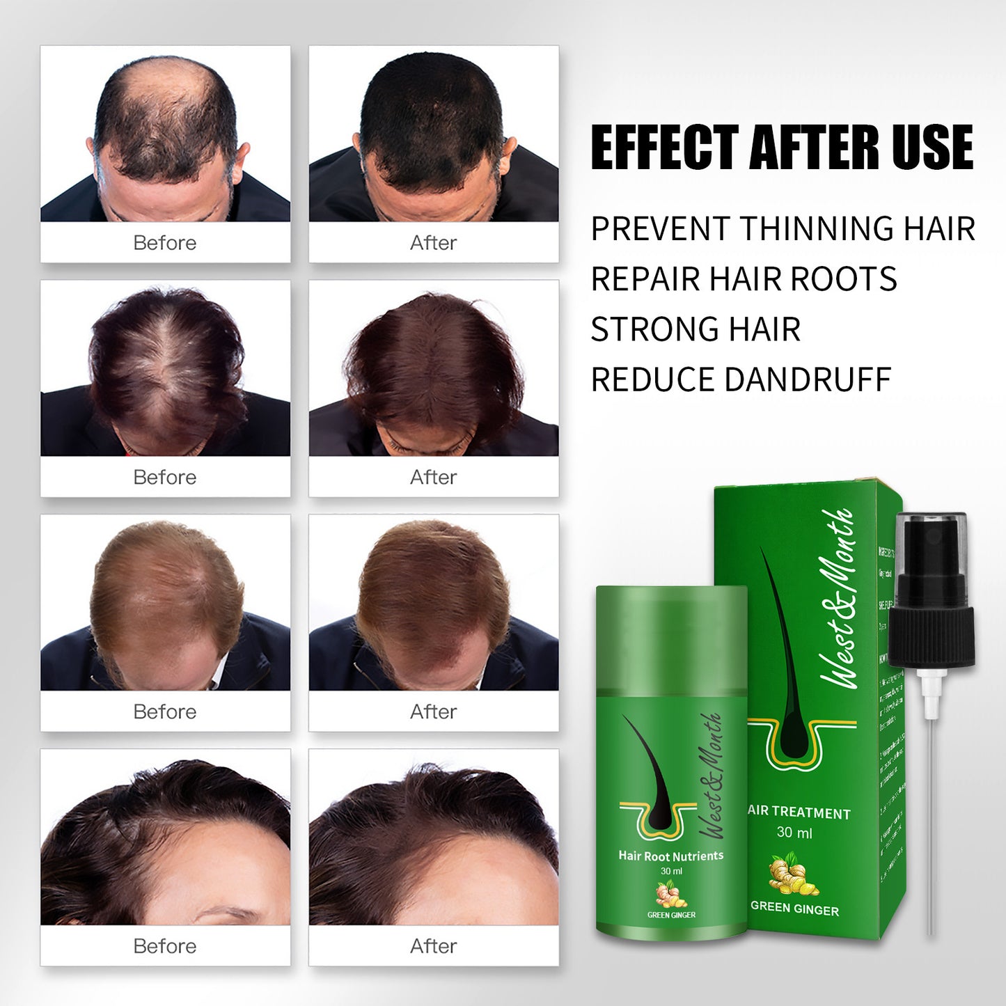 Sparkery West and Month Hair Booster